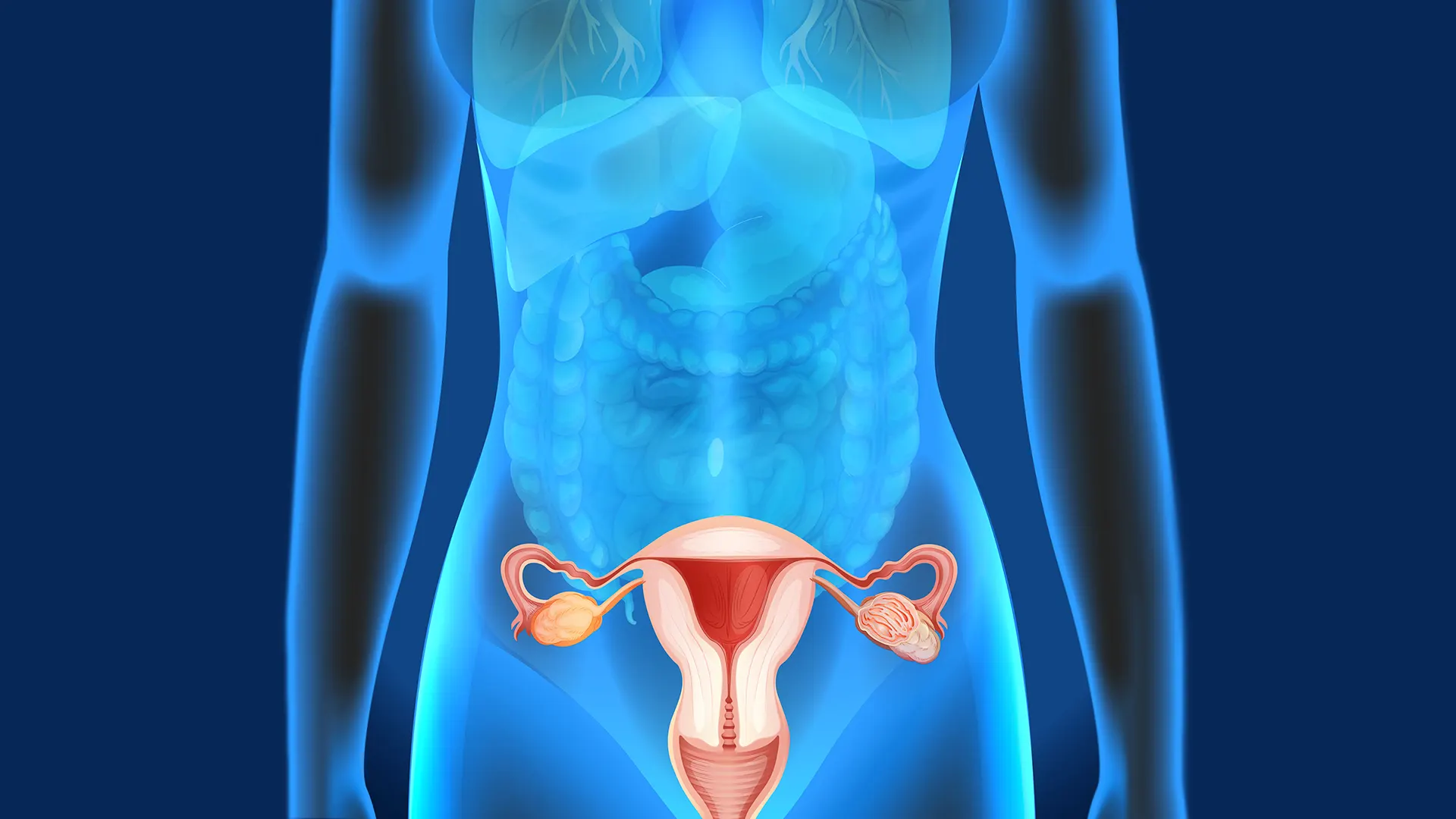 Endometriose: Por que o Foco Deve Estar no Intestino e no Fígado?